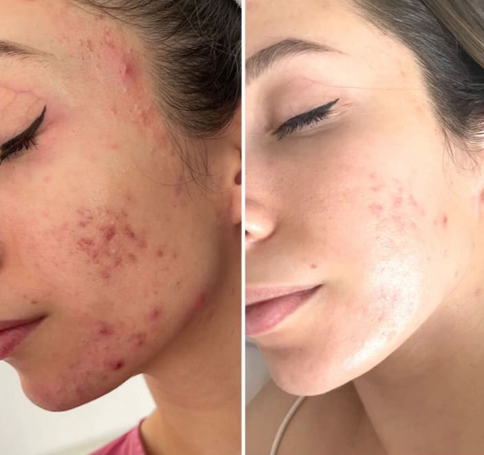 صابونة الكركم لتفتيح البشرة